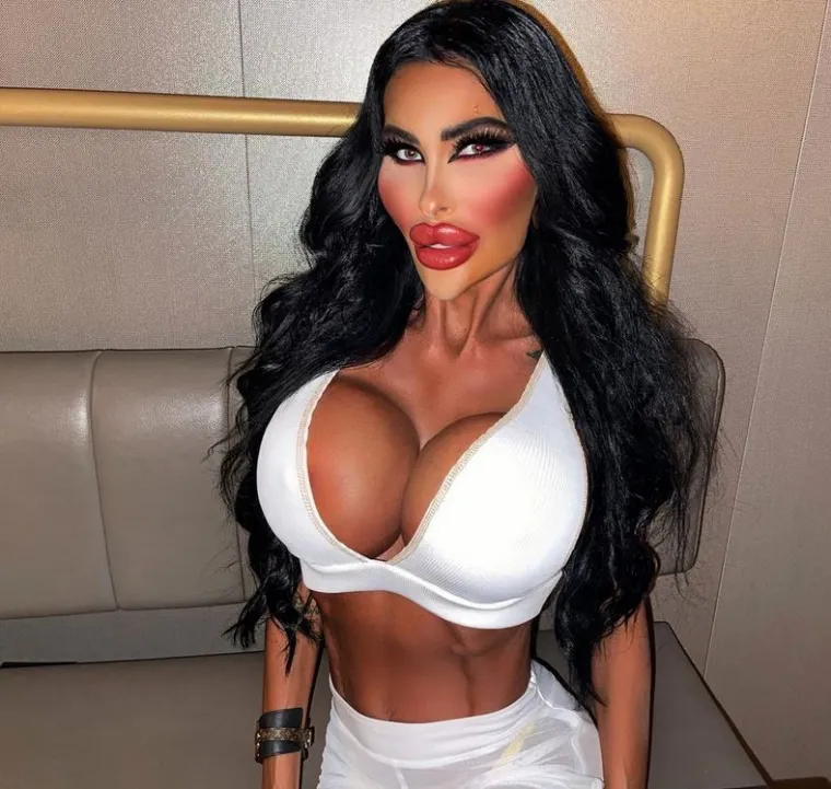 Iako su je tada stručnjaci odbili i savjetovali joj da se prvo posveti svom psihičkom, a onda fizičkom zdravlju, ona je dobronamjerne savjete zanemarila i nastavila se i dalje operirati.