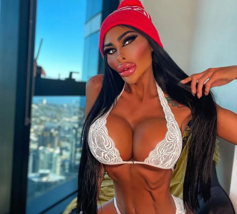 Kako mnoge njene procedure imaju samo privremene efekte, Tara i dalje mora trošiti tisuće dolara na održavanje.