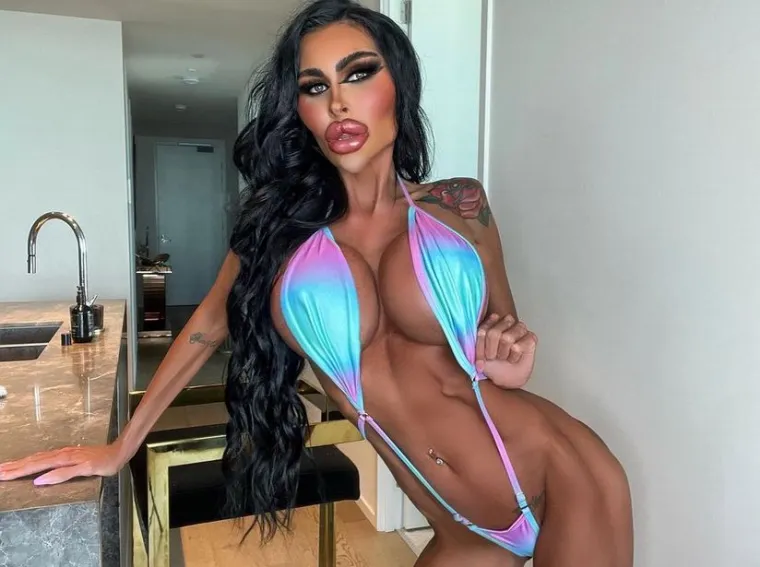 U godini dana mora ubrizgati botoks do 30 puta. 