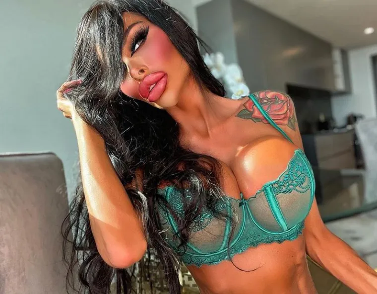 Gdje god se pojavi, ne obraća pažnju na poglede i ne tako lijepe komentare na račun njenog izgleda. Naprotiv, ponosno &scaron;eta, a s estetskim korekcijama, kako nagla&scaron;ava, ne planira prestati. 