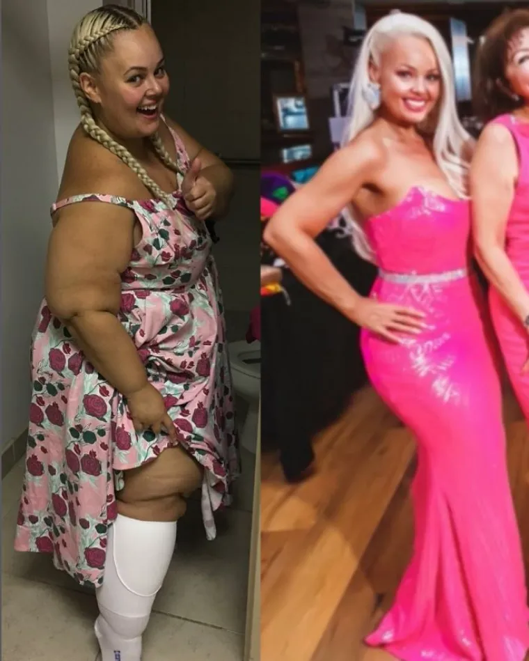 Kayla je tada odlučila da će smršaviti i od tada je izgubila impresivnih 88 kilograma u dvije godine. Odlučila je prihvatiti ketogenu dijetu umjesto prejedanja slatkim poslasticama, a također je podvrgnuta operaciji želučanog rukavca. Osim toga, počela je vježbati s utezima i raditi kardio treninge. Naporan rad joj se isplatio jer je sada zdrava i ima 63 kilograma.