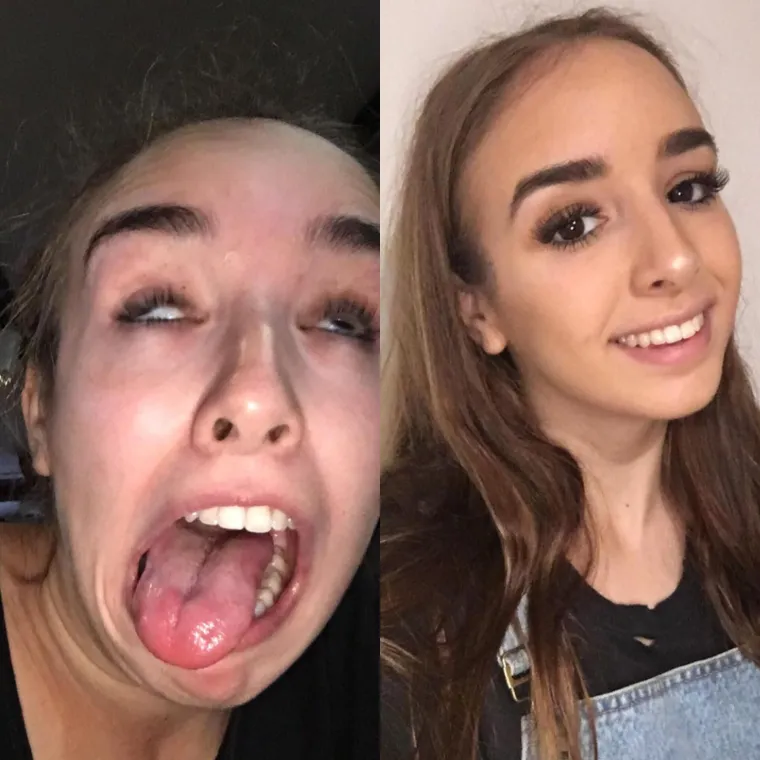 &Scaron;to kada bismo vam rekli da su sve ove cure prezgodne i da biste gadno požalili kada biste ih odbili poljubiti?