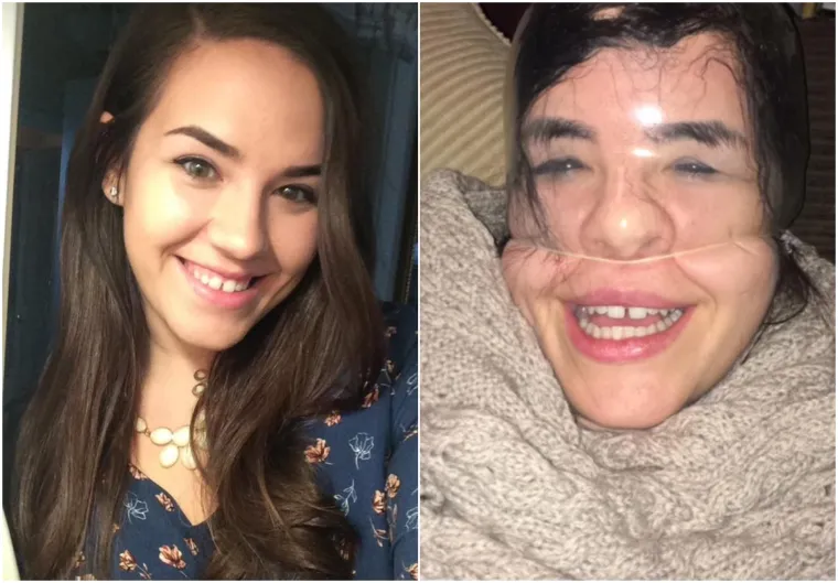 &Scaron;to kada bismo vam rekli da su sve ove cure prezgodne i da biste gadno požalili kada biste ih odbili poljubiti?