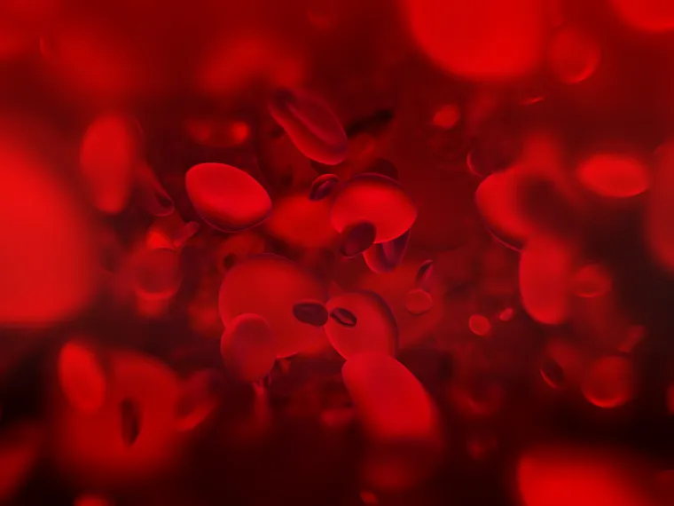 1. Nedostatak željeza: Najčešći poremećaj krvi je nedostatak željeza, koji se često javlja kod žena koje imaju gubitak krvi tijekom menstruacije, rekla je dr. Margaret V. Ragni, profesorica i direktorica Centra za hemofiliju zapadne Pennsylvanije. Osim toga, ljudi koji imaju nisku unos željeza - uključujući vegetarijance i vegane, djecu koja piju više od 453 grama kravljeg mlijeka i osobe s bolestima gastrointestinalnog trakta, uključujući celijakiju - visoko su izloženi riziku od anemije. Ostali uobičajeni faktori rizika su trudnoća, dojenje, velika operacija ili fizička trauma. Željezo je potrebno za održavanje funkcija tijela i zdravih stanica, kože, noktiju i kose, omogućujući tijelu da obnavlja crvene krvne stanice u koštanoj srži. Zbog smanjenih razina kisika u krvi uzrokovanih niskim željezom, može doći do promjena u prirodnom pigmentu kože. 