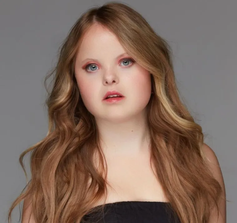 Beth Matthews ima za cilj promijeniti perspektivu ljudi o Downovom sindromu. Beth je postigla više nego što je itko od nje očekivao. Modeling, nastupi uživo na TV-u i radiju te članci o njoj načini su na koje Beth pomiče granice i zastarjela mišljenja o životu s Downovim sindromom.