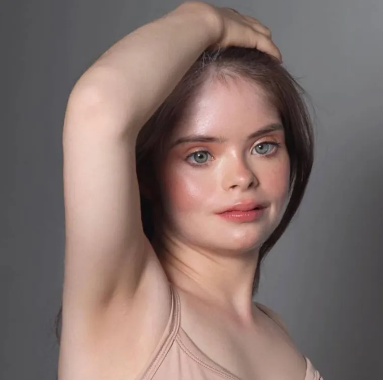 Jessica Jacinto se kao tinejdžerica okušala u različitim sportovima, no niti jedan ju nije usrećio. Ali, zato je sudjelovala na izboru ljepote za djevojke s Downovim sindromom gdje je zablistala. Ima veliku podršku okoline, a ona ističe da najviše vjeruje svojoj majci. 
