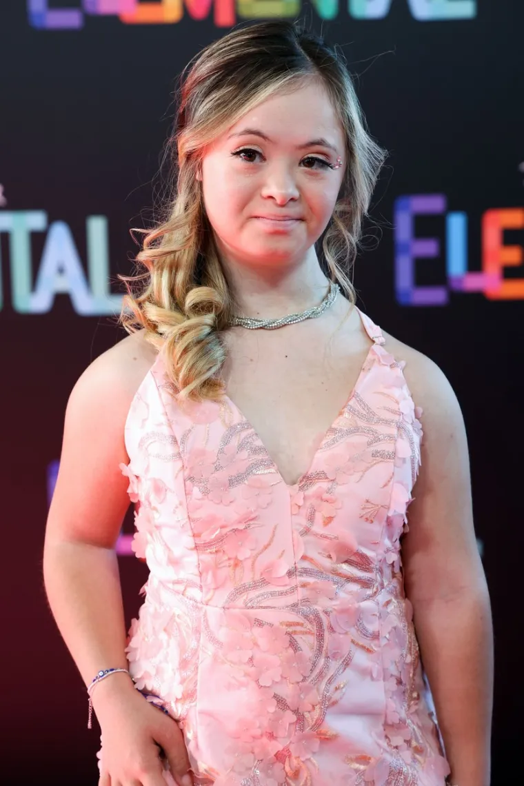 Kennedy Garcia je influencerica, model za legendarne brendove, snima filmove, drži javne govore, pa čak i sudjeluje u plesnim natjecanjima. Njezina upornost  snaga inspiriraju cijeli svijet.