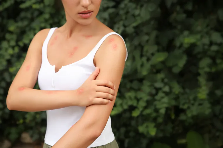 Zbog ovih pet stvari vas komarci ne prestaju gristi: Reagiraju na određene mirise i boje, a jedno piće ih posebno mami
