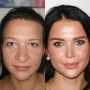 Turska klinika hvali se na Instagramu nevjerojatnim transformacijama pacijenata