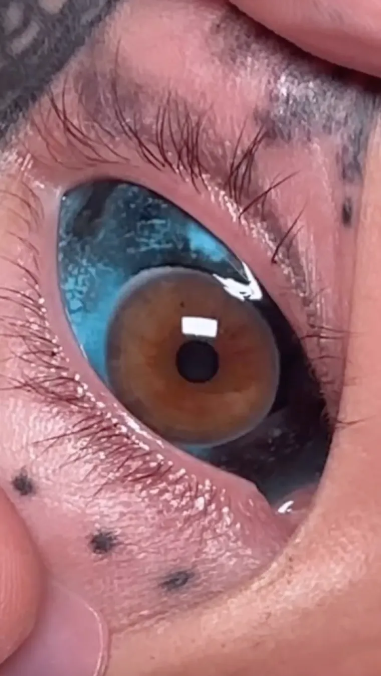 Nekoć je bila plavuša iz susjedstva nevina lica, no otišla je toliko daleko da je istetovirala čak i oči