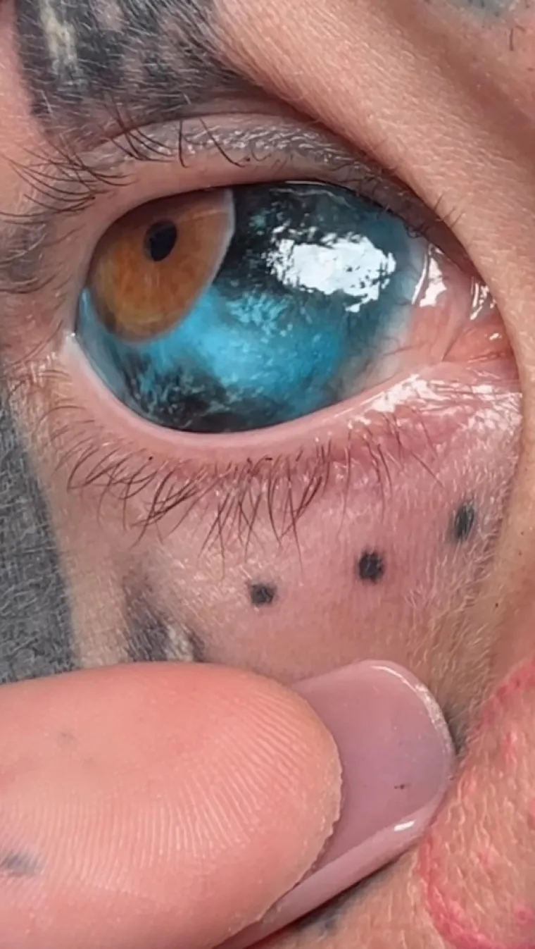 Nekoć je bila plavuša iz susjedstva nevina lica, no otišla je toliko daleko da je istetovirala čak i oči