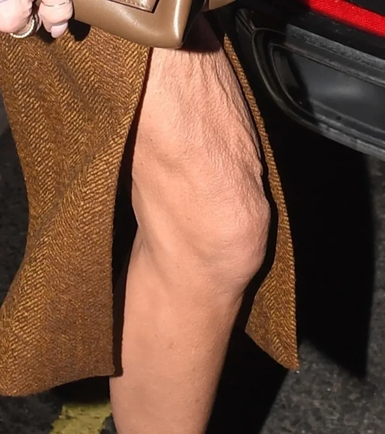 Vicotira Beckham