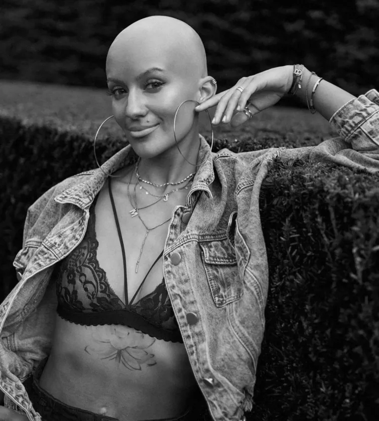 Nakon operacije grudi suočila se s velikim problemom: 'Sada izgledam kao Gollum'