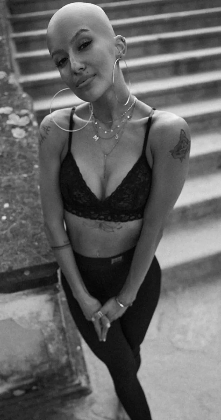 Nakon operacije grudi suočila se s velikim problemom: 'Sada izgledam kao Gollum'