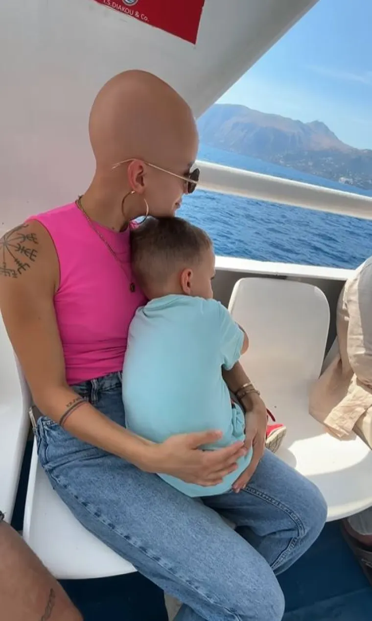 Nakon operacije grudi suočila se s velikim problemom: 'Sada izgledam kao Gollum'