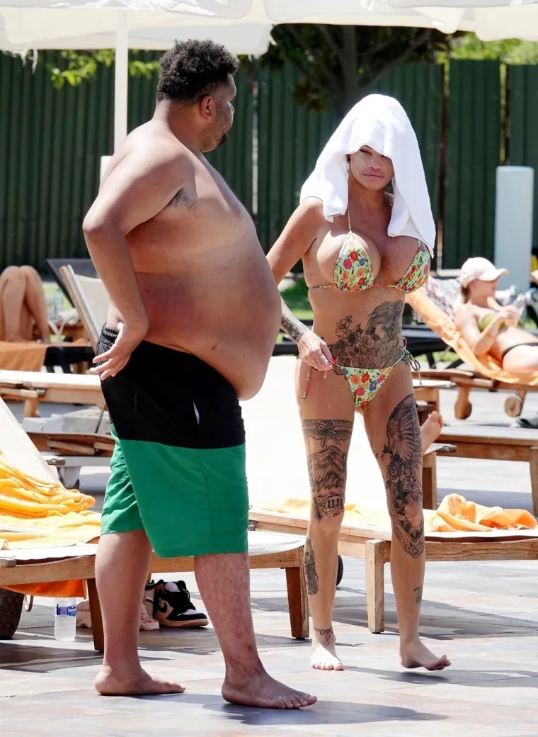 Britanska reality zvijezda Katie Price šokirala nakon operacije lica
