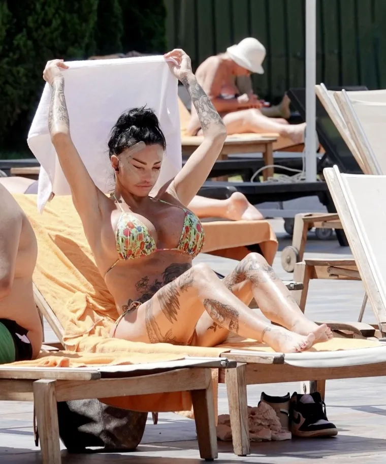 Britanska reality zvijezda Katie Price šokirala nakon operacije lica