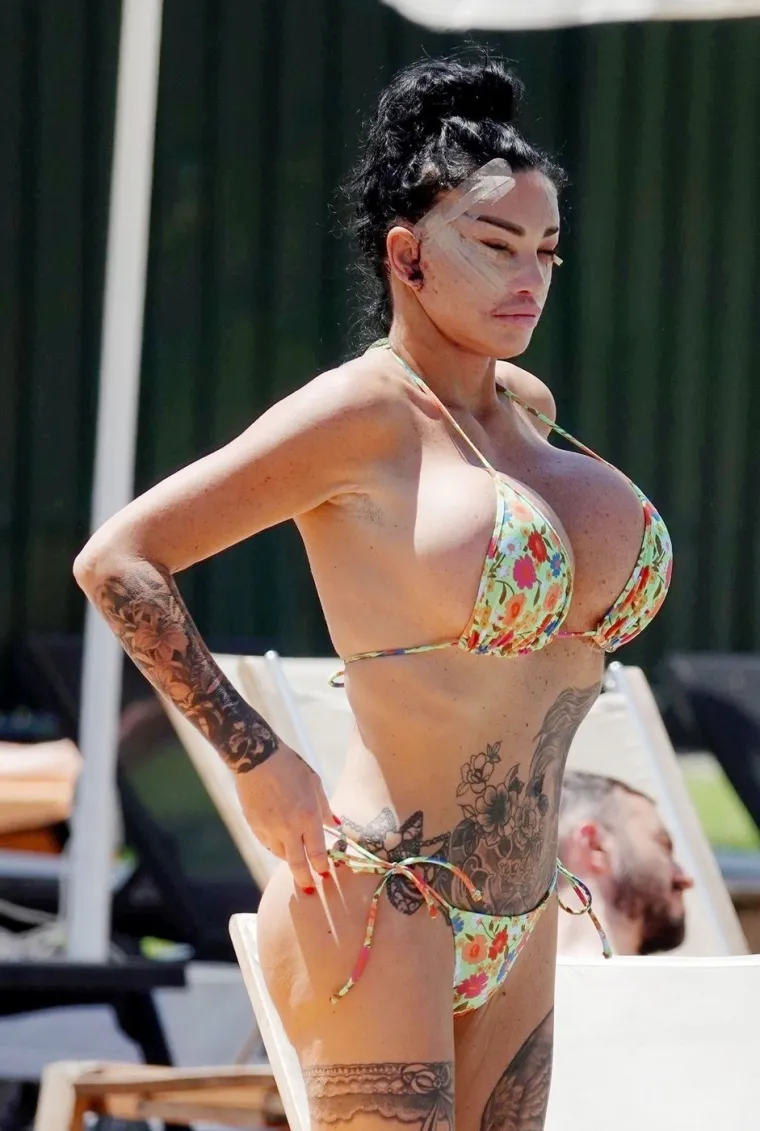 Britanska reality zvijezda Katie Price šokirala nakon operacije lica
