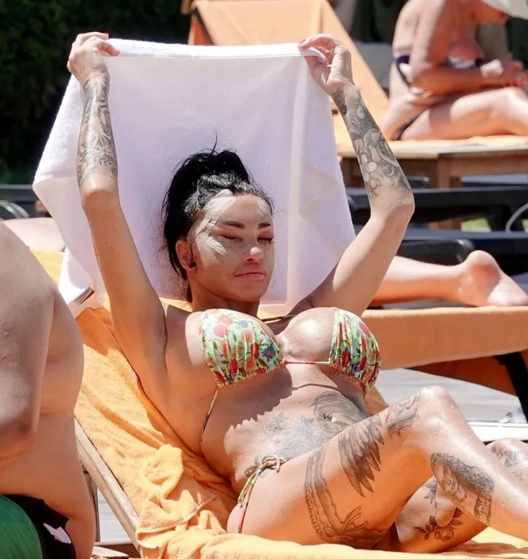 Britanska reality zvijezda Katie Price šokirala nakon operacije lica