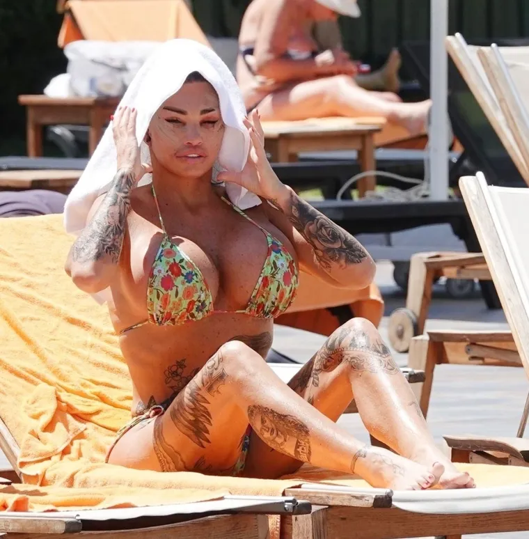 Britanska reality zvijezda Katie Price šokirala nakon operacije lica