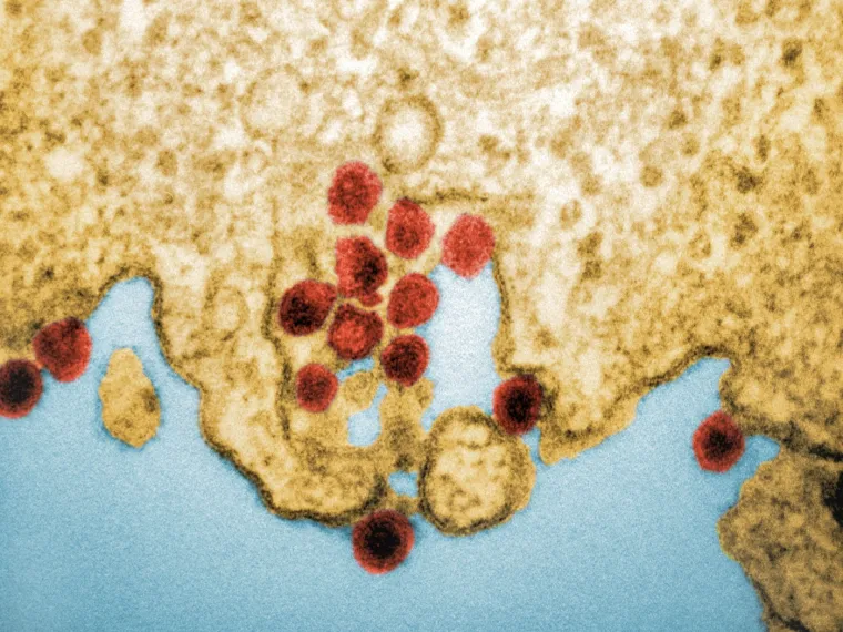 Chikungunya je virus koji šire dva različita aedes invazivna komarca: Aedes i albopictus. Naziv bolesti na afričkom kimakonde jeziku znači &quot;zgrčiti se&quot;  jer uzrokuje jake bolove u mišićima i zglobovima. Ostali simptomi uključuju iznenadnu groznicu, glavobolju, umor, osip, mučninu i crvenilo očiju. Većina pacijenata će se oporaviti unutar nekoliko tjedana, ali u nekim slučajevima bolovi u zglobovima mogu potrajati tjednima, mjesecima ili čak i duže.