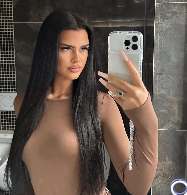 Podvrgnula se tretmanu: Evo kako Nelly Nelnoire izgleda nakon riskantne operacije