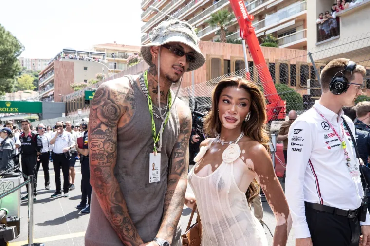 Ovo je Winnie Harlow - manekenka koja boluje od iste bolesti kao Michael Jackson