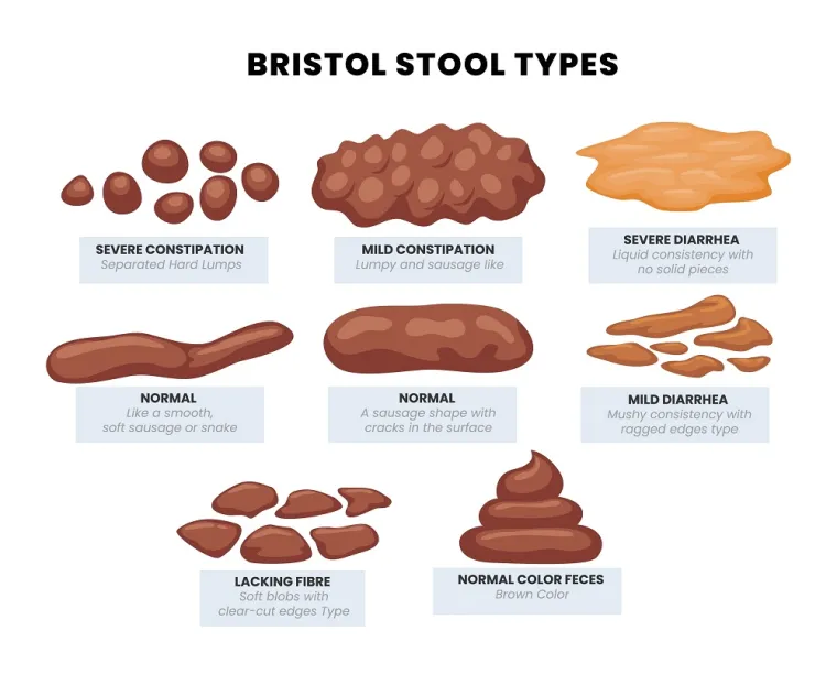 Općenito govoreći, postoji zapravo sedam različitih tipova izmeta koji su klasificirani Bristolskom ljestvicom stolice. &quot;Napravljena je kako bi pomogla ljudima da liječnicima opišu svoju stolicu i kao skraćenica za medicinsko osoblje da zabilježi što su im pacijenti rekli&quot;, objasnio je dr. Mayhead.