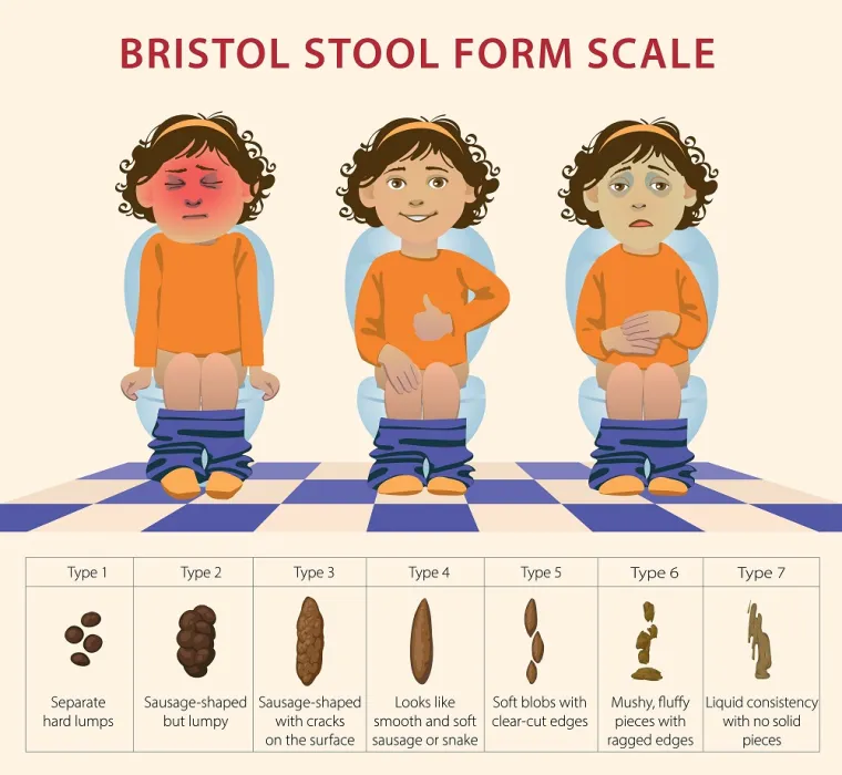 
4. Koje bi boje trebao biti izmet?