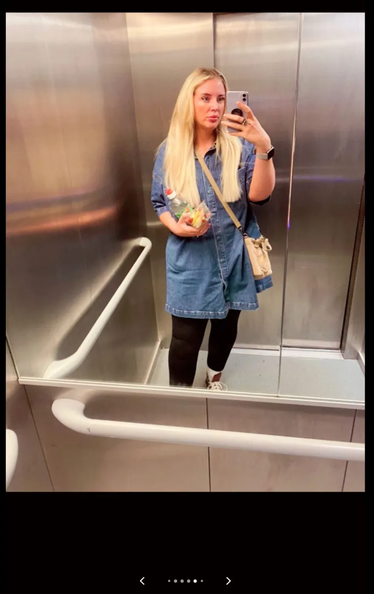 Rosie se borila održati se na nogama tijekom naporne smjene na poslu i podvrgnula se skupoj operaciji želuca.
