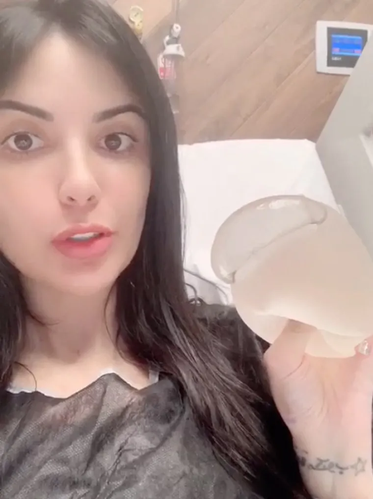 Platila milijun da izgleda kao Kim Kardashian, pa proživjela agoniju