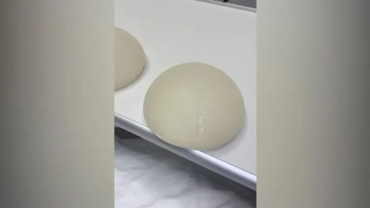 Platila milijun da izgleda kao Kim Kardashian, pa proživjela agoniju