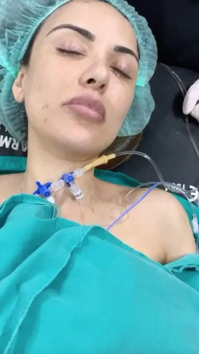 Platila milijun da izgleda kao Kim Kardashian, pa proživjela agoniju