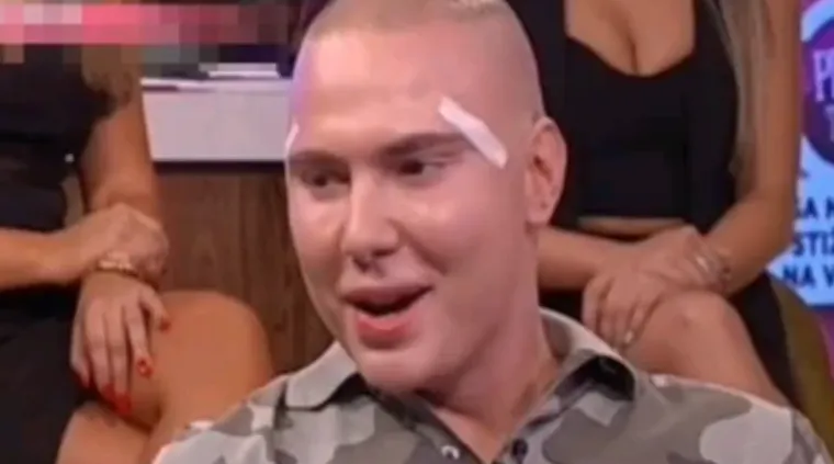 Da, ovo je Brendon! Prošao je kroz brojne estetske zahvate, evo kako se mijenjao