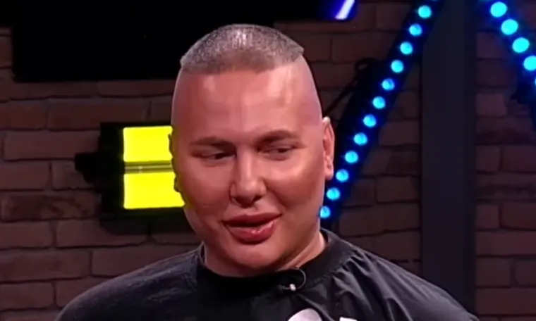 Da, ovo je Brendon! Pro&scaron;ao je kroz brojne estetske zahvate, evo kako se mijenjao