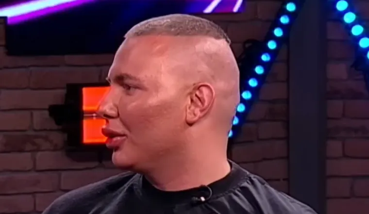 Da, ovo je Brendon! Pro&scaron;ao je kroz brojne estetske zahvate, evo kako se mijenjao