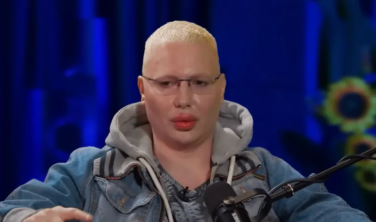 Da, ovo je Brendon! Pro&scaron;ao je kroz brojne estetske zahvate, evo kako se mijenjao