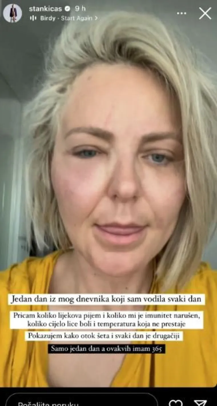 Evo kako je Stankica iz 'Gospodina Savršenog' izgledala prije ubrizgavanja filera