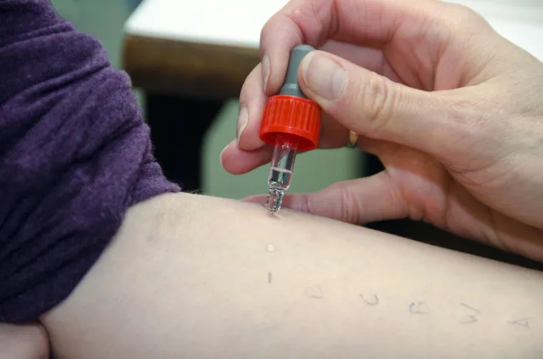 Dr. Tang kaže: "Dijagnoza alergije uključuje promatranje simptoma u odnosu na izloženost i može uključivati testiranje alergije."