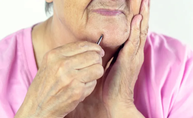 "Dlačice su se progustile na licu i polako nestaju sa svih ostalih mjesta s godinama", pokazala je jedna studija.