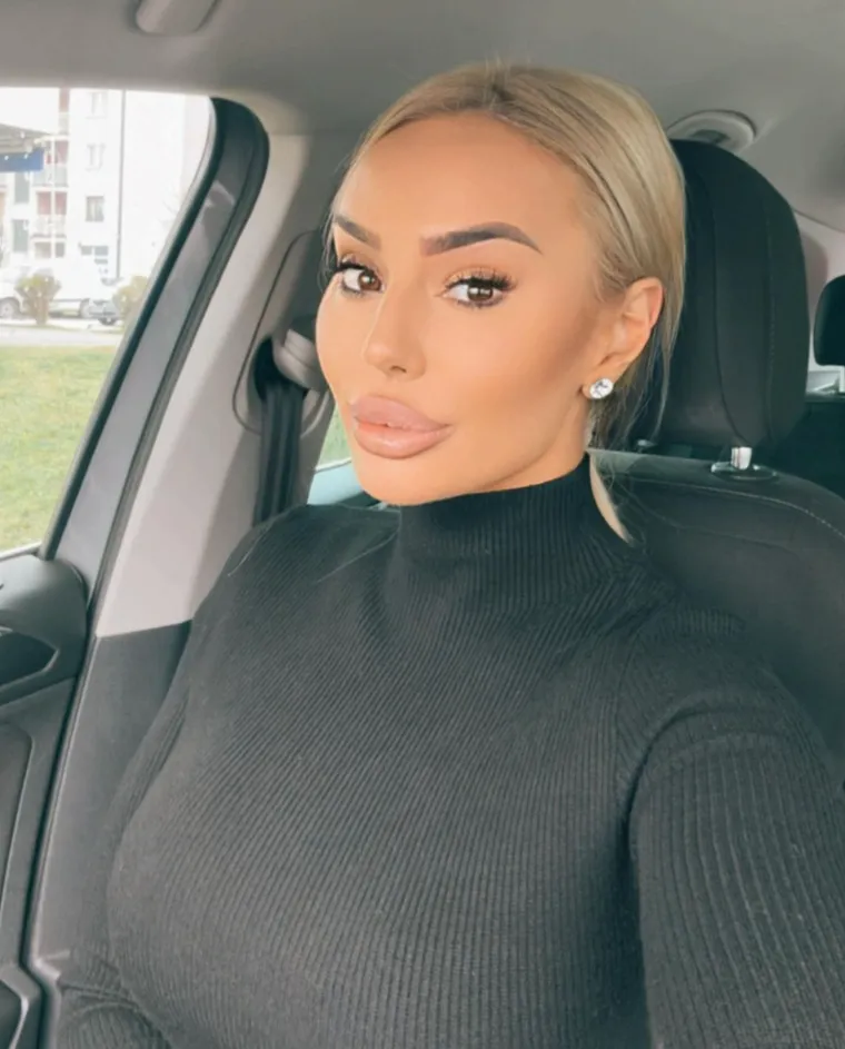 Rođena 18. listopada 1994. godine u Mokrom, Šljivić je prepoznata ne samo po svojim političkim angažmanima već i po svom glamuroznom načinu života, što je redovito stavlja u centar pažnje medija. 