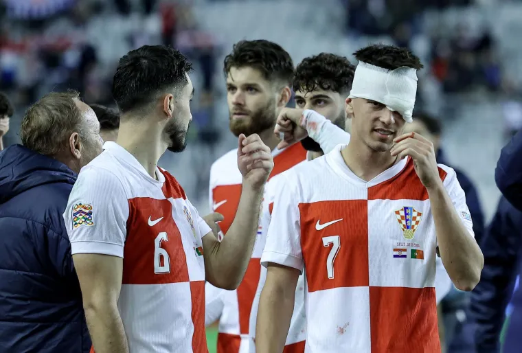 Nikola Moro pretrpio je prekršaj Fabija Silve