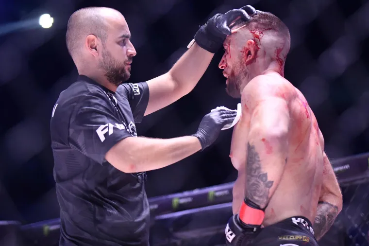 Juri&scaron;ić je zaradio dobre posjekotine po glavi, ali to je ni&scaron;ta u usporedbi s kasnijim borbama.