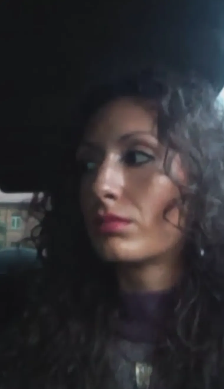 &quot;Bila si jako lijepa, ozbiljno, razmisli o tome&quot;, neki su od komentara koji se mogu pronaći ispod objave na Instagramu u kojoj je pokazala kako je izgledala prije operacija.