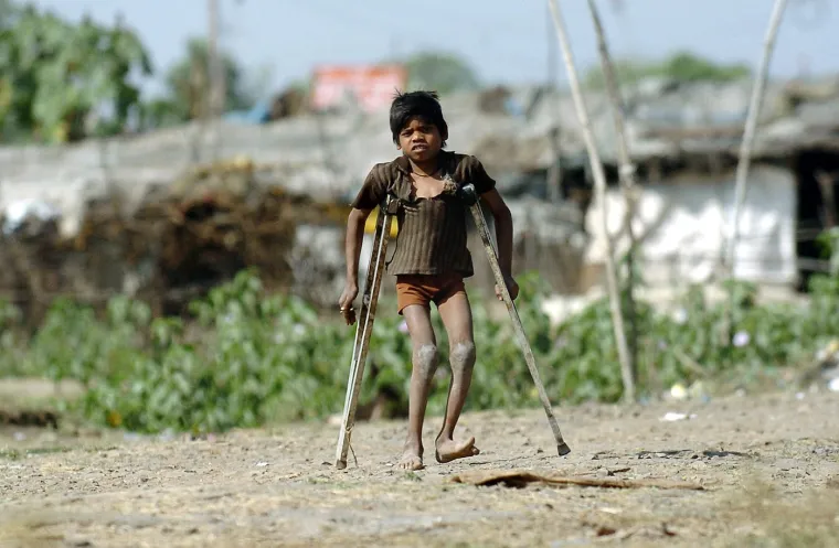 I 40 godina nakon katastrofe u kojoj je poginulo 3500 ljudi, djeca se i dalje rađaju bez očiju