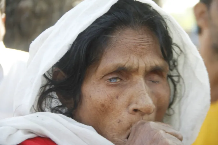 I 40 godina nakon katastrofe u kojoj je poginulo 3500 ljudi, djeca se i dalje rađaju bez očiju