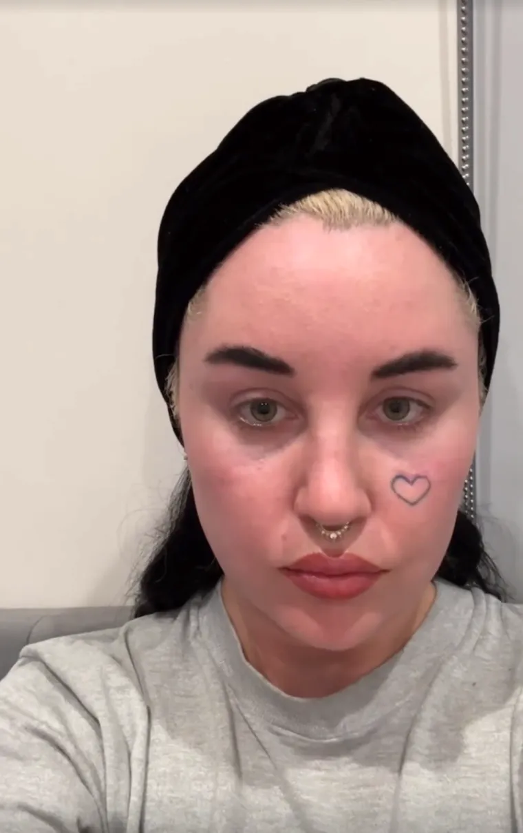 U 2018. godini, Bynes je izjavila da je trijezna četiri godine uz podr&scaron;ku svojih roditelja te je izrazila žaljenje zbog svojih prethodnih postupaka