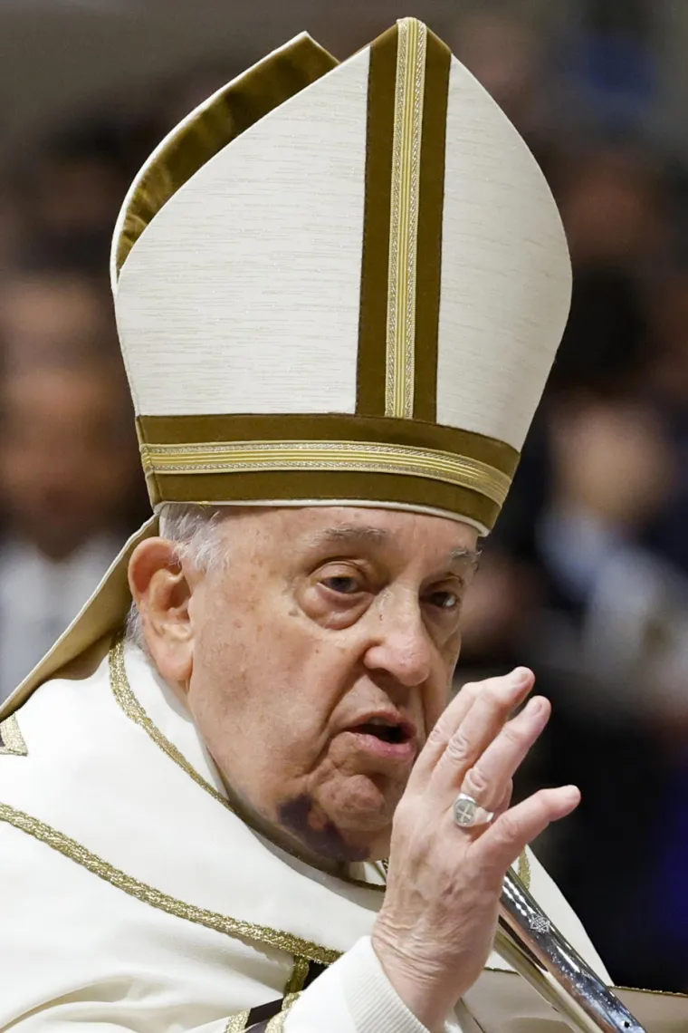 Pao dok je ustajao iz kreveta? Papa Franjo vodio misu za kardinale s licem punim modrica