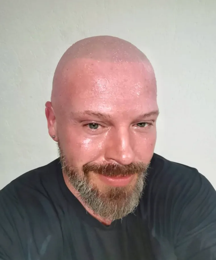 Prije Aline - on je bio rekorder: Pogledajte nevjerojatnu transformaciju pobjednika treće sezone