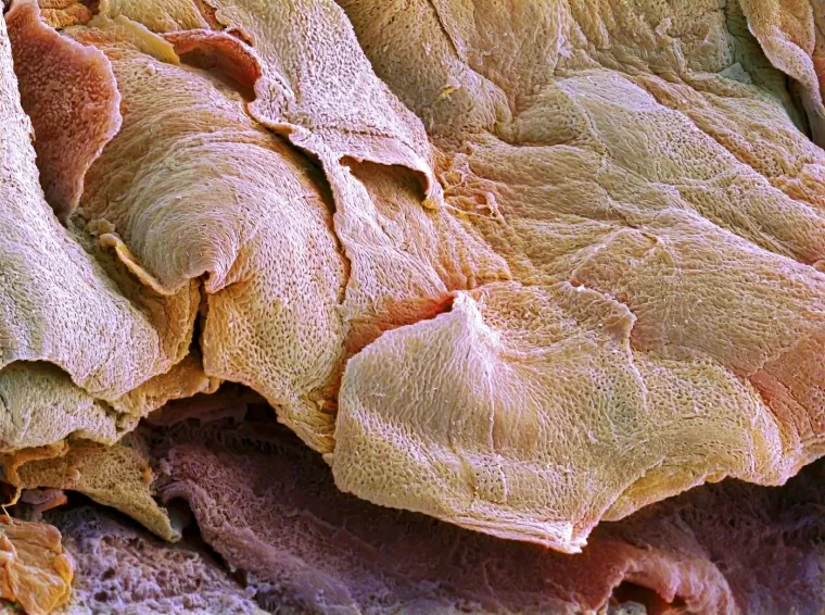 Keratinociti - stanice kože koje sadrže protein keratin. Oni migriraju na mjesto rane i formiraju slojeve koji tvore krastu.
